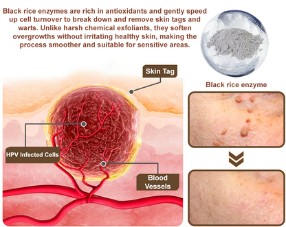 LOVILDS® Black Rice Skin Repair Essence Cream (Removes warts and skin growths, improves keratin buildup and seborrheic dermatitis, follicular keratosis, age spots, and bruising)