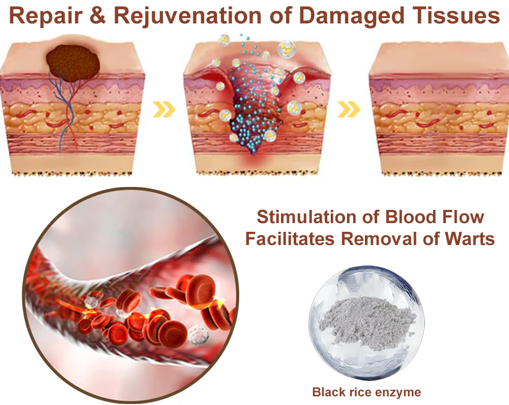 LOVILDS® Black Rice Skin Repair Essence Cream (Removes warts and skin growths, improves keratin buildup and seborrheic dermatitis, follicular keratosis, age spots, and bruising)
