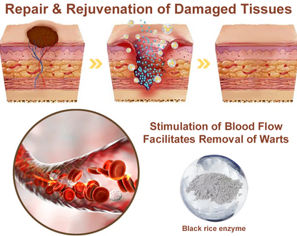 LOVILDS® Black Rice Skin Repair Essence Cream (Removes warts and skin growths, improves keratin buildup and seborrheic dermatitis, follicular keratosis, age spots, and bruising)
